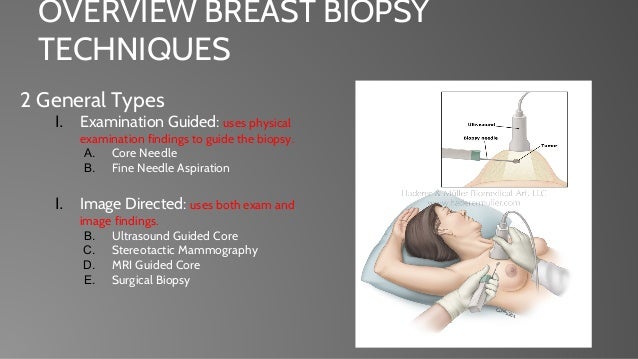 ultrasound guided needle biopsy and breast Home gay videos
